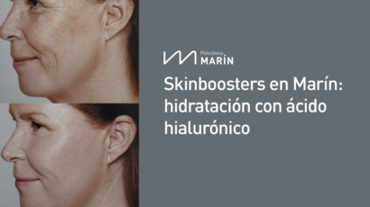 skinboosters-en-marin-medicina-estética